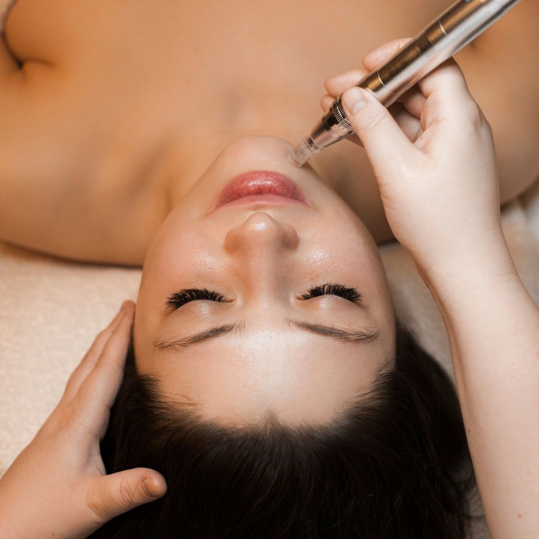 Microneedling Course : What To Look For